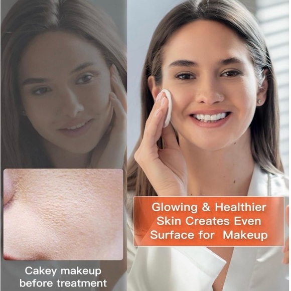 White LED Light Therapy Mask set - Picture 4 of 6